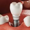Effective Management Strategies for Dental Clinics