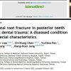 CAD/CAM در دندانپزشکی مدرن Horizontal root fracture in posterior teeth without dental trauma: A diseased condition with special characteristics Wan-Chuen Liao a,b,1 , Chi-Hung Chen a,b,1 , Yu-Hwa Pan c ,