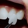 تاثیر رضایت بیمار بر افزایش بازدهی مطب دندانپزشکی لمینت دندان