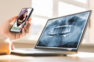 تله دندانپزشکی