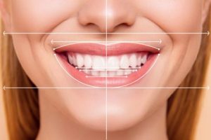  طراحی لبخند سه‌بعدی (3D Smile Design)