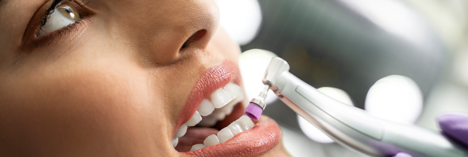 خمیر پولیش دندانپزشکی